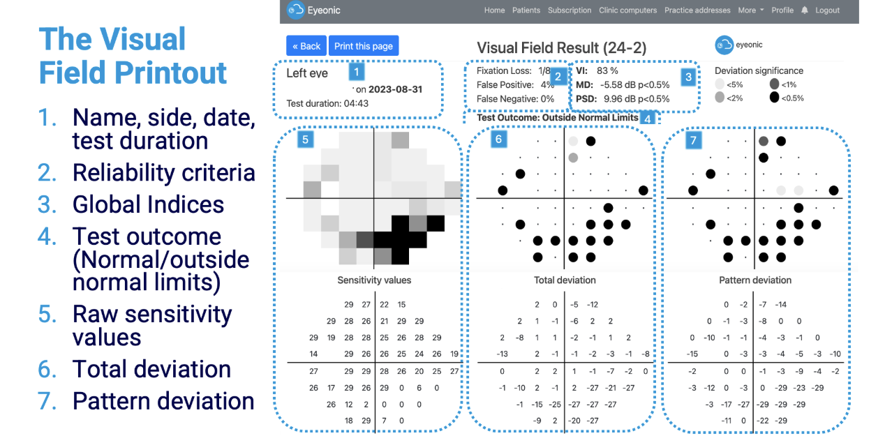 The Visual Field Printout - Eyeonic report explainer showing sensitivity values, total deviation and pattern deviation